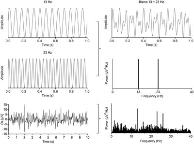 Bi-sinusoidal light stimulation reveals an enhanced response power and reduced phase coherence at the visual cortex in migraine